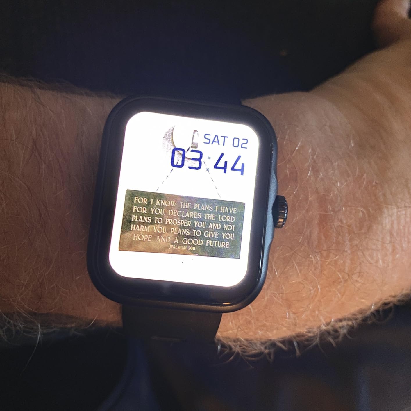 My Anyloop Ultra is Great Watch