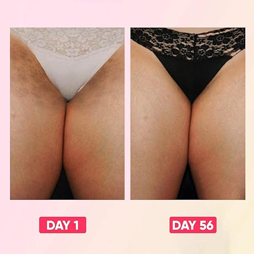 Miniatura 5 de Dear Kitty Crema aclaradora íntima para áreas privadas  Crema para manchas oscuras  Corrector natural de manchas oscuras para partes privadas,