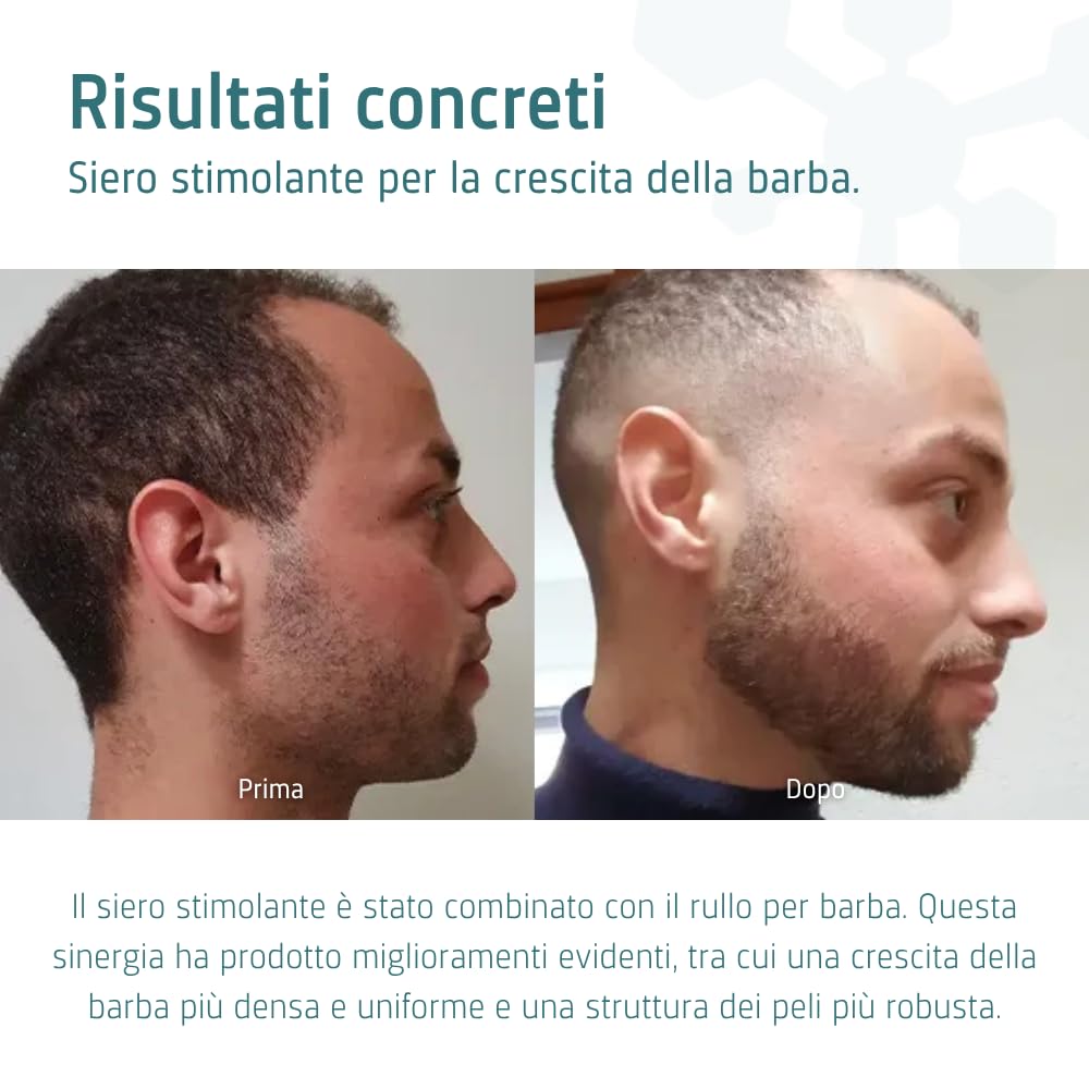 Siero stimolante la crescita della barba Neofollics - 45 ml - L'81% ha riscontrato una maggiore crescita dei peli del viso - Con il 7% di Neoxyl: 41% più efficace del Minoxidil