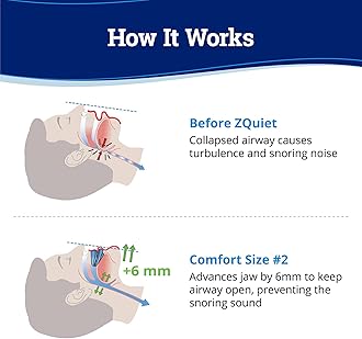 ZQuiet Anti-Snoring Mouthpiece Solution - Comfort Size #2 (Single Device) + Cleaner (1.5oz Bottle) - Made in USA Snoring Solution for a Better Night’s Sleep (Blue)