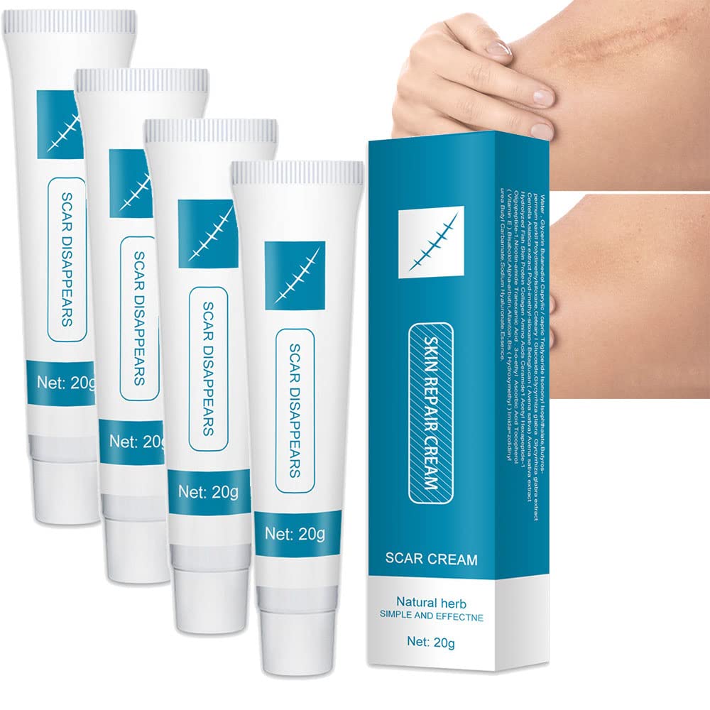 Scar & Acne Bump Removal Cream, Scar & Acne Bump Re_moval Cream, West Month Skin Scar Repair Cream, Scar Repair Cream, Stretch Mark Removal Cream, Fade Scar Marks 20g (4pcs)