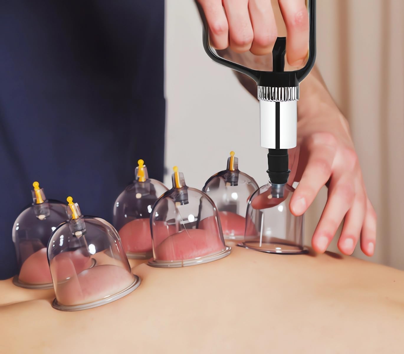 Juego de 20 ventosas para terapia de ventosas, tamaño grande V2.0, para hombres y mujeres, vasos de vacío para músculos corporales, dolor de espalda, masaje, celulitis, ventosa, juego de