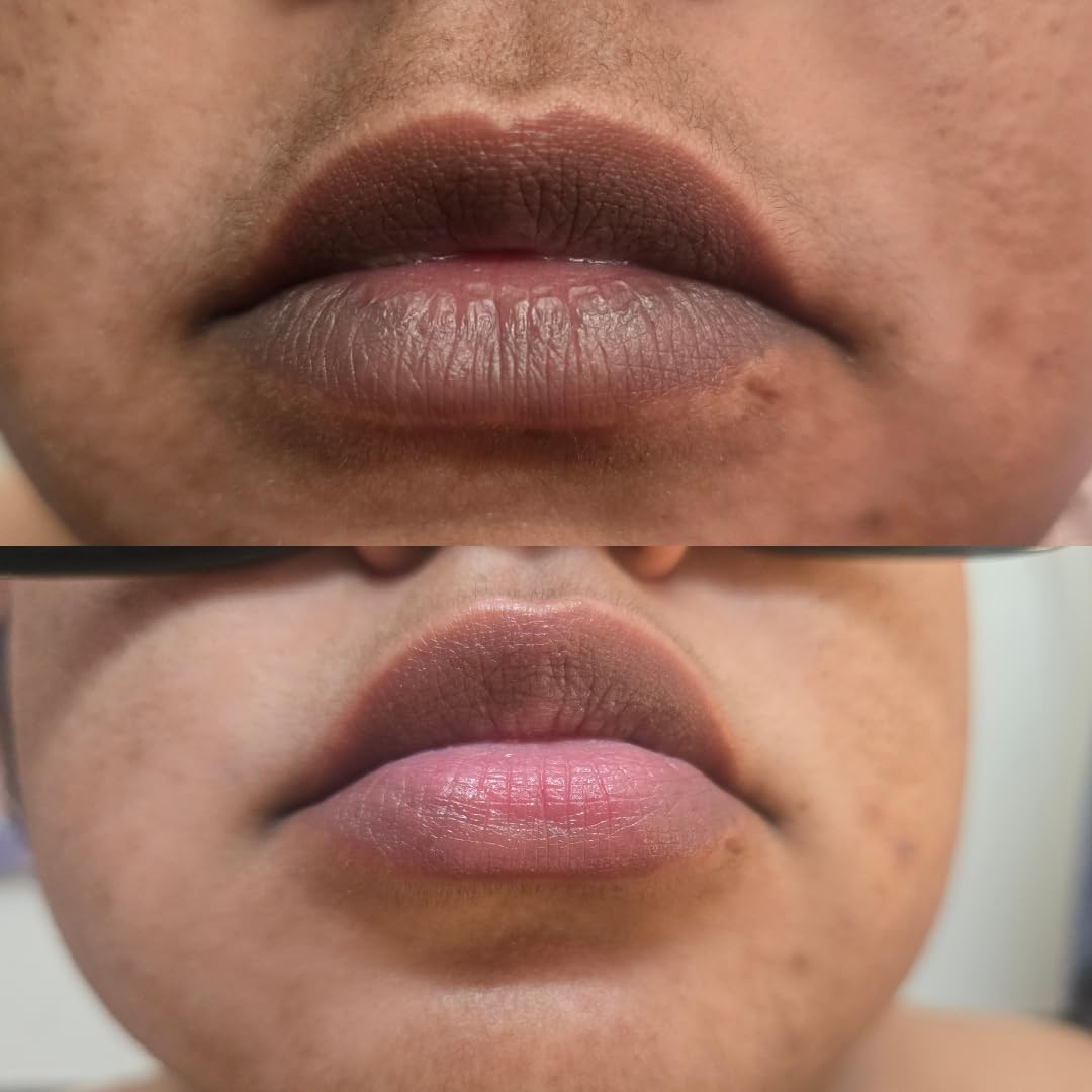 Generic Lip Lightening for Dark Lips, Lip Brightening for Dark Lips, Dark Lip Treatment Serum for Smokers, Dry or Uneven, Restores Natural Look & Moisture with VC, Licorice & Jojoba Seed Oil