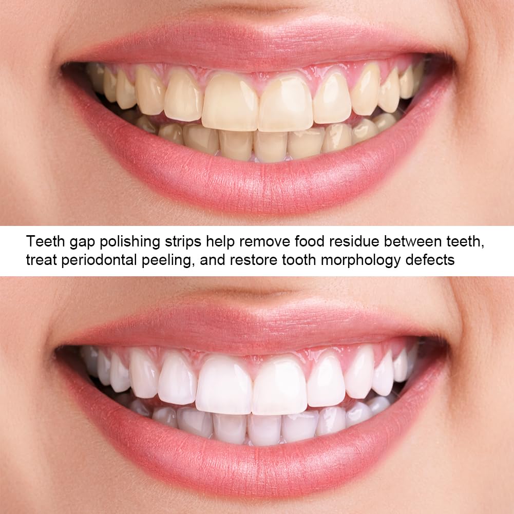 Carta vetrata dentale 3 pezzi striscia lucidatura rimozione tartaro