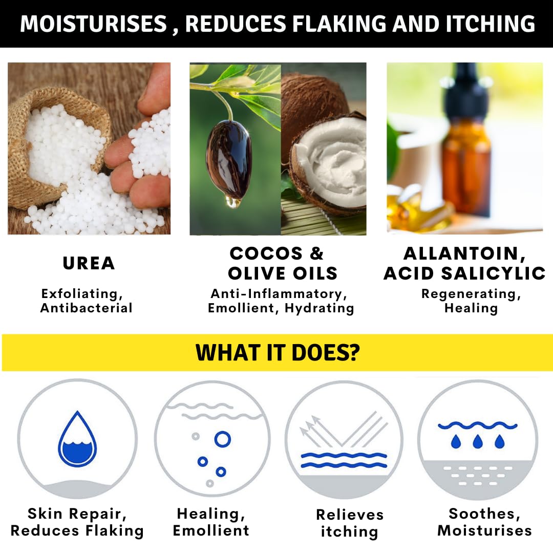 Crema Urea 20%, Eczemi, Cheratosi, Psoriasi, Eruzioni Cutanee, Riduce il Prurito, Sechezza, Pelle Secca e Screpolata, Calli, Duroni, Desquamazioni,- Cocos e Olio d'Oliva, 50g