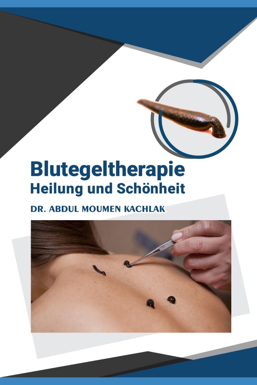 Blutegeltherapie Heilung und Schönheit: „Anwendung, Wirkung und Pflege mit Blutegeln“