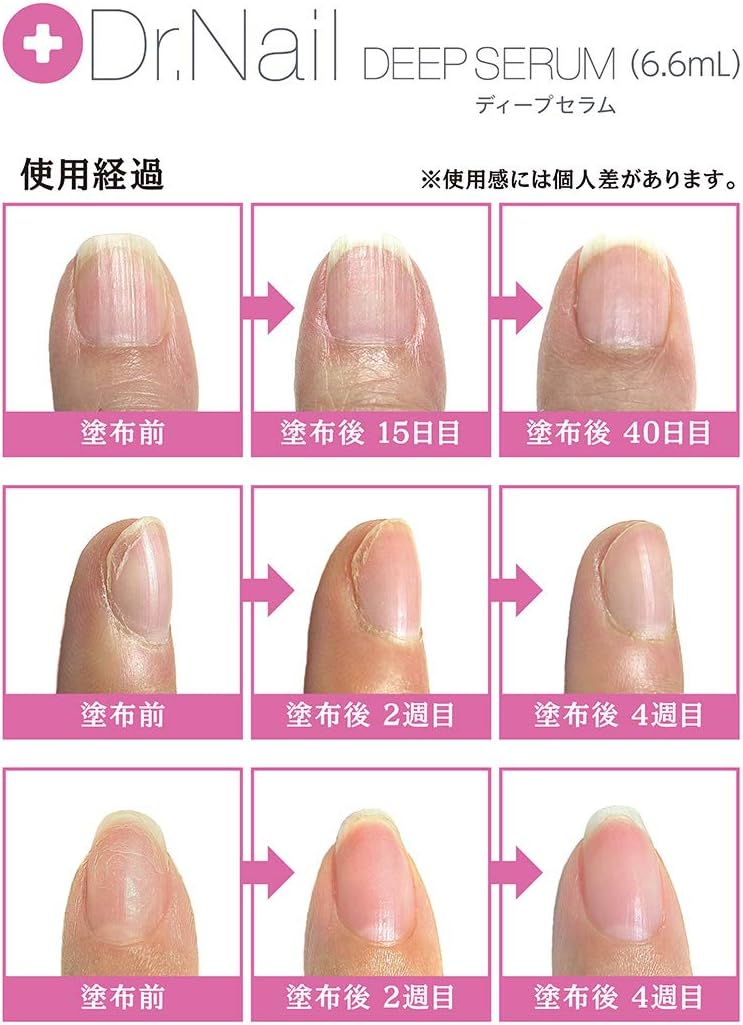 Amazon Co Jp マルコ Maruko Pb ドクター ネイル ディープ セラム Rs 6 6ml ビューティー