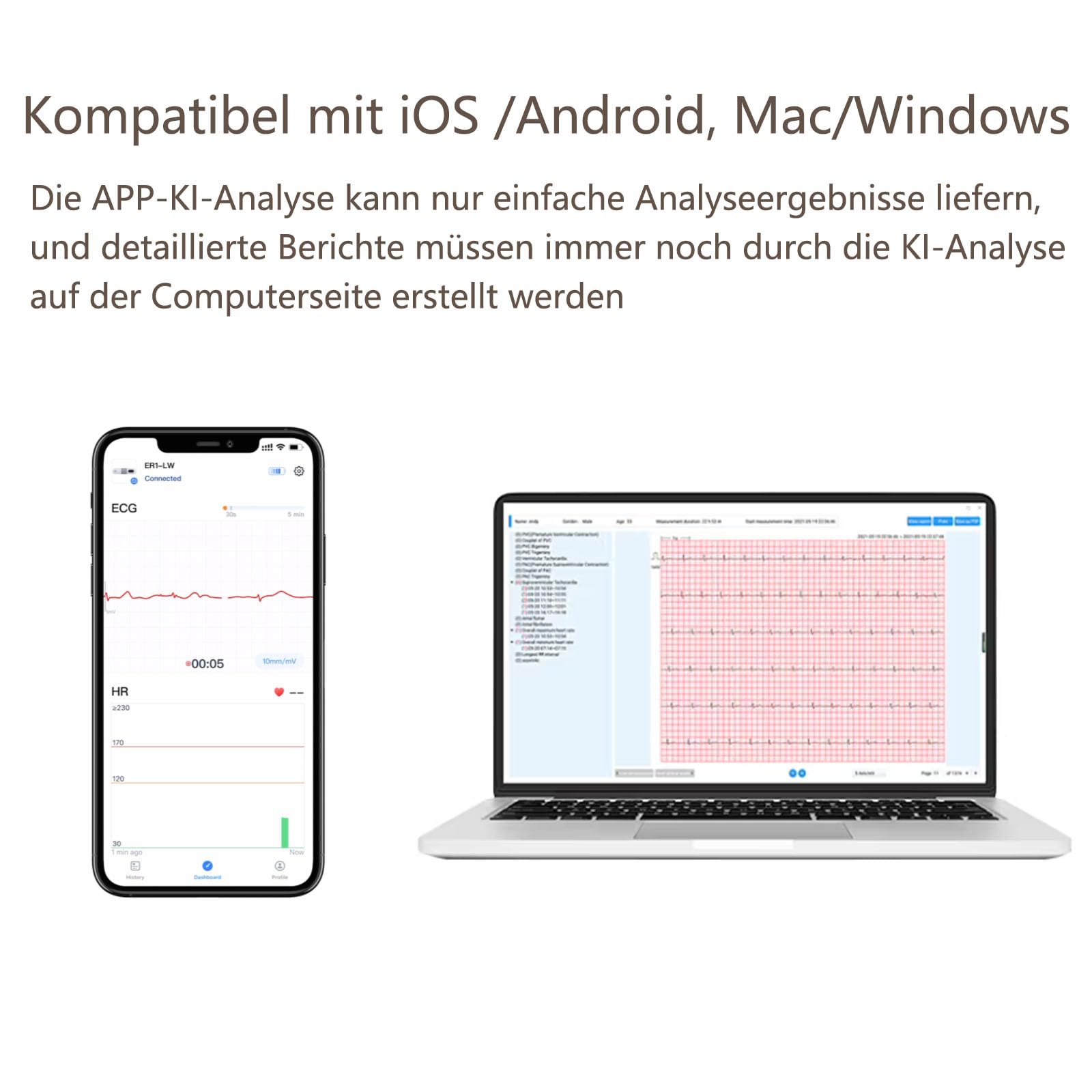 Wellue 24 ore dispositivo ECG per la casa, analisi AI, ECG Event Recorder, compatibile con Ios e Android, Mac e Windows, tempo di monitoraggio da 5 minuti a 24 ore
