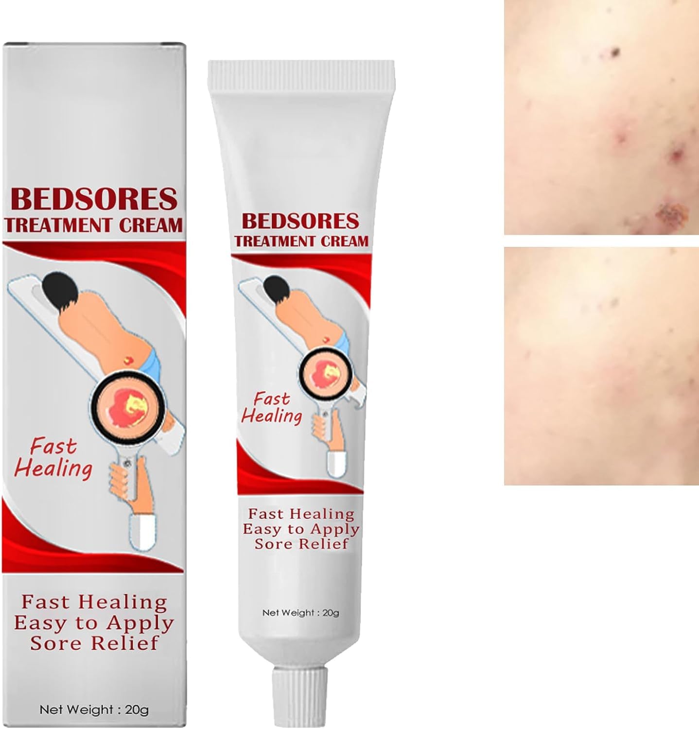 Azonee Bedsore Repair Cream, Wound Healing Ointment, Fast-Acting Bedsore Cream, Rapid Wound Healing Gel, Bedsore Wound Care, Pressure Sore Relief Cream