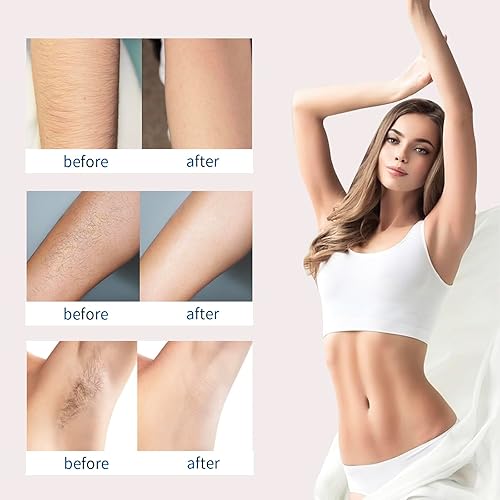 Miniatura 5 de Crema de depilación, depilación para el cuerpo
