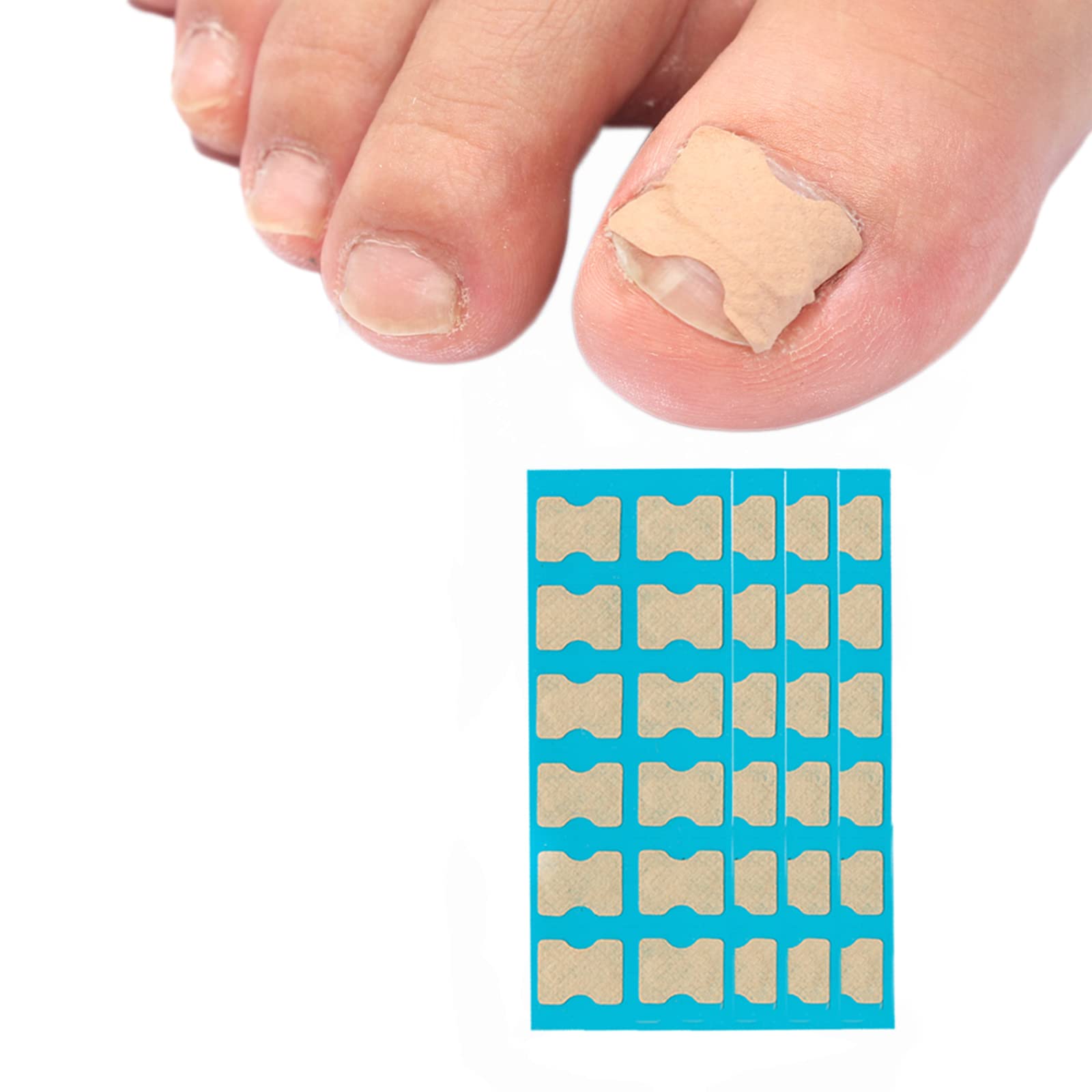 POSICHE Nail Sticker Corrector 36Pcs Ingrown Toenail Correction Stickers, Glue-Free Correction Nail Paste Embedded Nail Paste Double-Sided Adhesive Corrector Pull Paste Pedicure Tool Foot Care