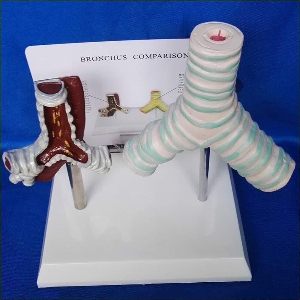 Human Trachea Anatomy Model, Smoking Trachea and Normal Trachea Comparison Model, Respiratory System Structure Organ Anatomy, for Medical Teaching Display.
