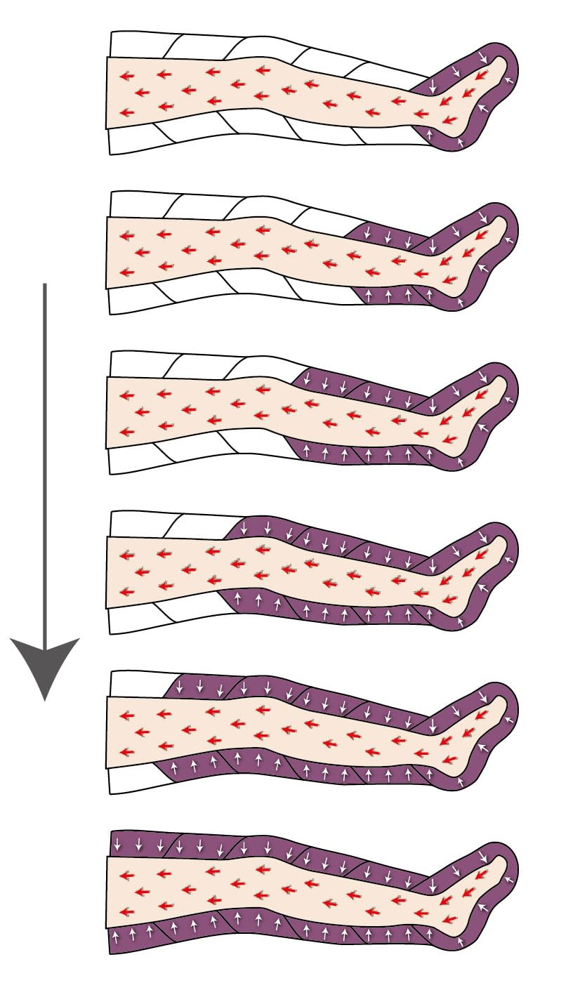 MESIS PressoMedical 1.0 SIX6 à 6 chambres Équipé PRO (avec 2 jambières, 1 bande abdominale/fessier et 1 brassard, pressothérapie lymphodrainage)