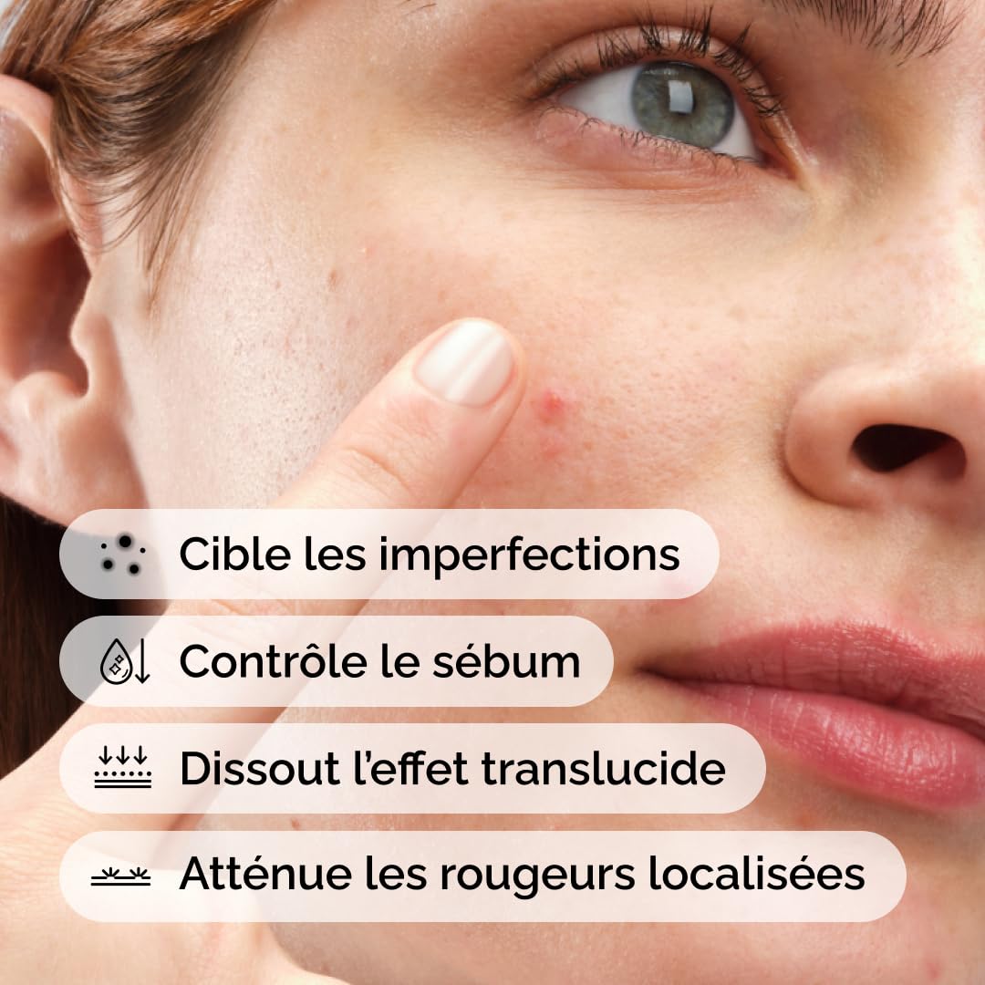 The Ordinary Concentré Crème-en-Poudre de Soufre 10%, Traitement ciblé des imperfections, permet de réduire l'apparence des éruptions cutanées, 5 g