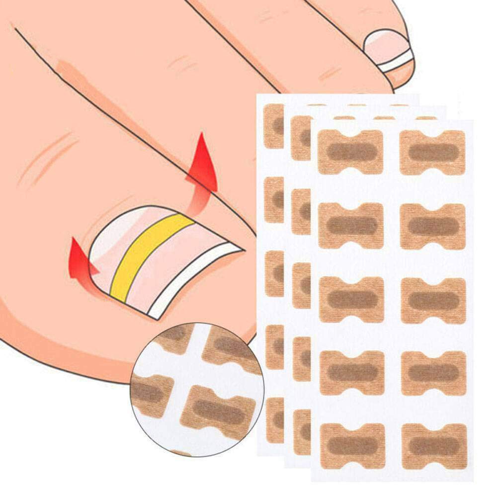 Juego de 5 parches de uñas sin pegamento – Kit de herramientas encarnadas para uñas de los pies para tratamiento de uñas, herramienta de corrección de uñas encarnadas para eliminar las uñas de los pies remiendo profesional para mantener las uñas saludable