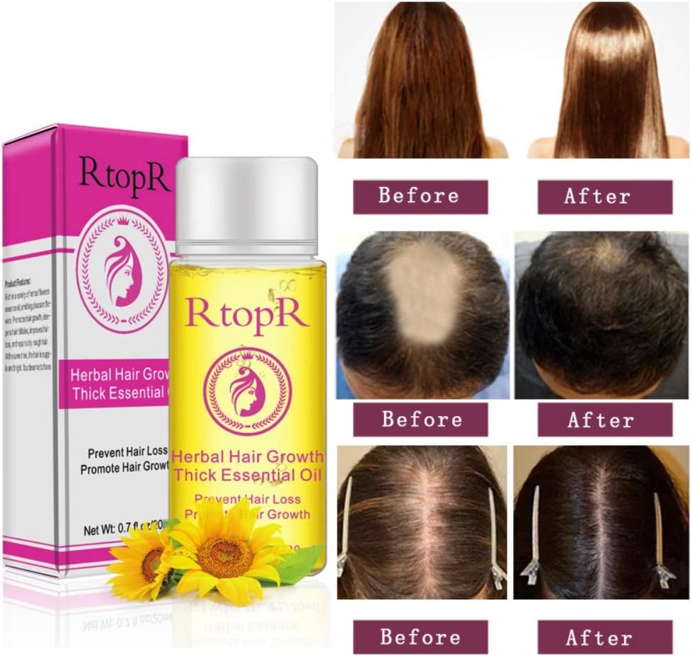 Hair Growth Essential Oil Black and Shines Repair Prevent Hair Loss Promote Extract Moist Nourishing Serum Yiitay For Moisturizing, Healing, Dry Skin, Hair Regrowth Onkessy