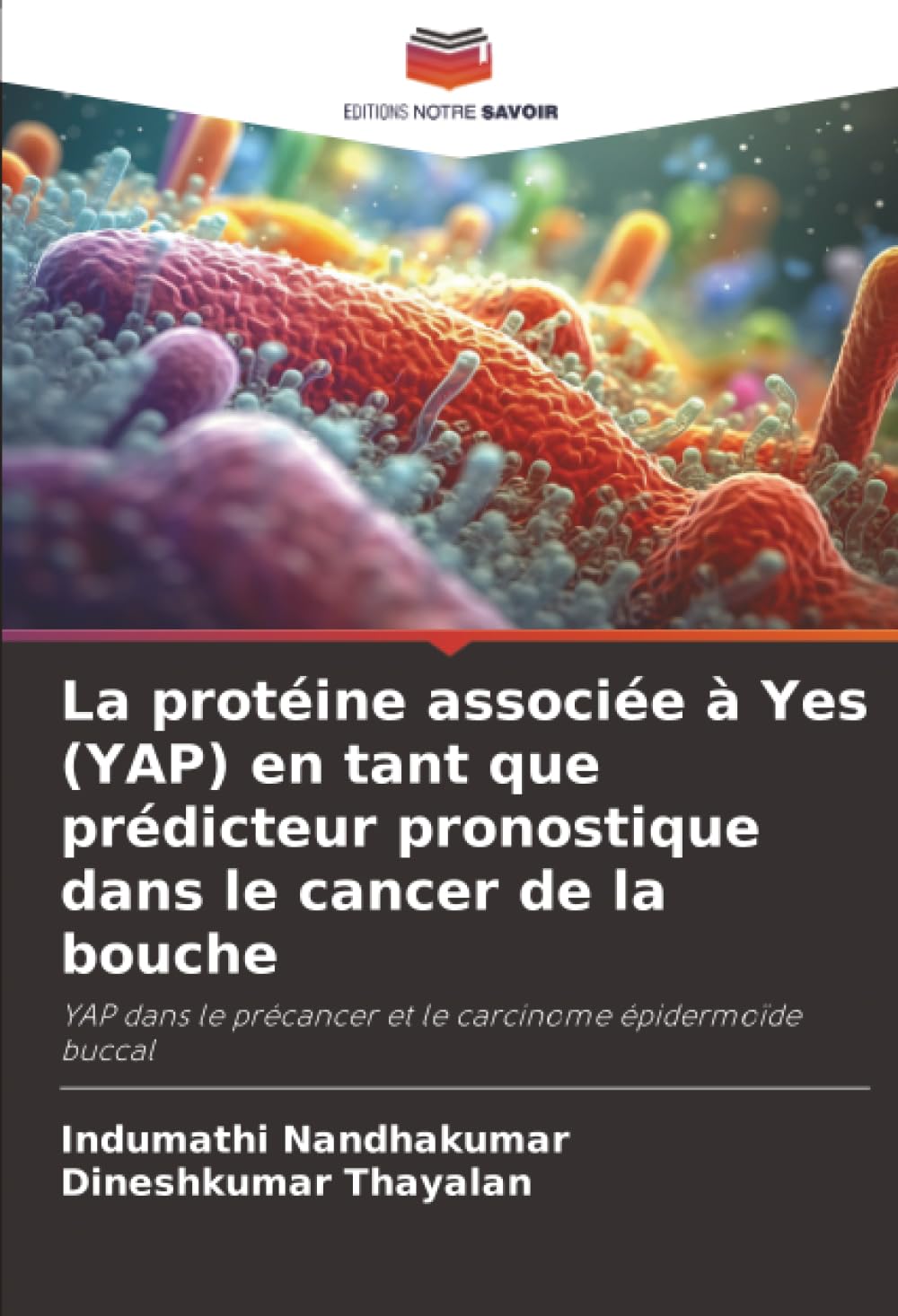 La protéine associée à Yes (YAP) en tant que prédicteur pronostique dans le cancer de la bouche: YAP dans le précancer et le carcinome épidermoïde buccal