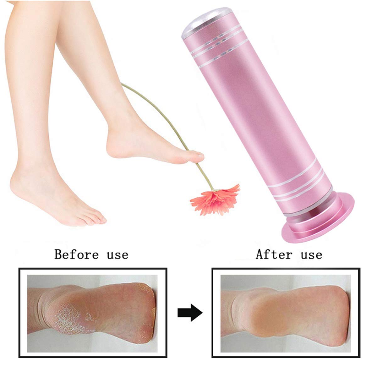 MIAOZHANG Raspa Piedi Elettrico Lima Piedi Tool di Cura dei Piedi A eliminare 2a Generazione Professionale Rimuovi Calli Piedi per Piedi Asciutti Pelle Morta e Screpolata,C