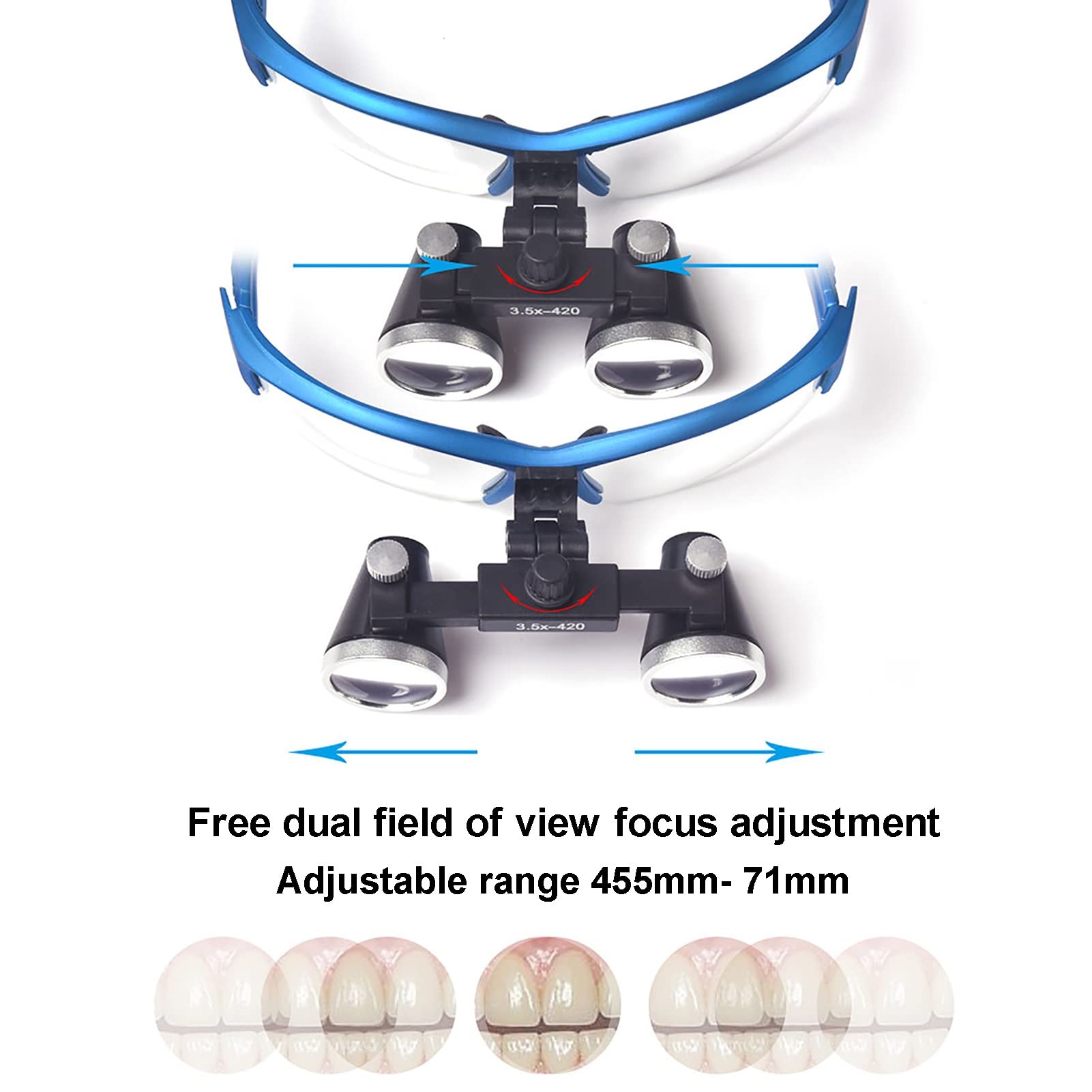 Occhialini Binoculari 2,5X 3,5X, + Vetro Ottico Binoculare Chirurgico Portatile Con Luce Frontale A LED 5W Per Lenti Chirurgiche Chirurgiche Mediche Del Dentista Lenti D'Ingrandimento Binoculari ( Col