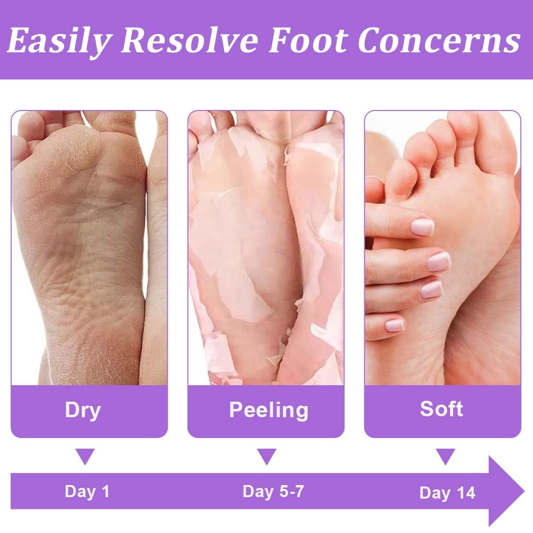 2 Paires masque pieds peeling exfoliant, Masque peeling pied, Callus peeling pieds