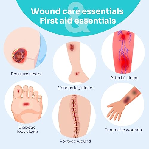 Miniatura 6 de Conkote Paquete de 10 almohadillas antiadherentes superabsorbentes, 4 x 4 pulgadas, vendajes absorbentes estériles no adhesivos, almohadillas suaves