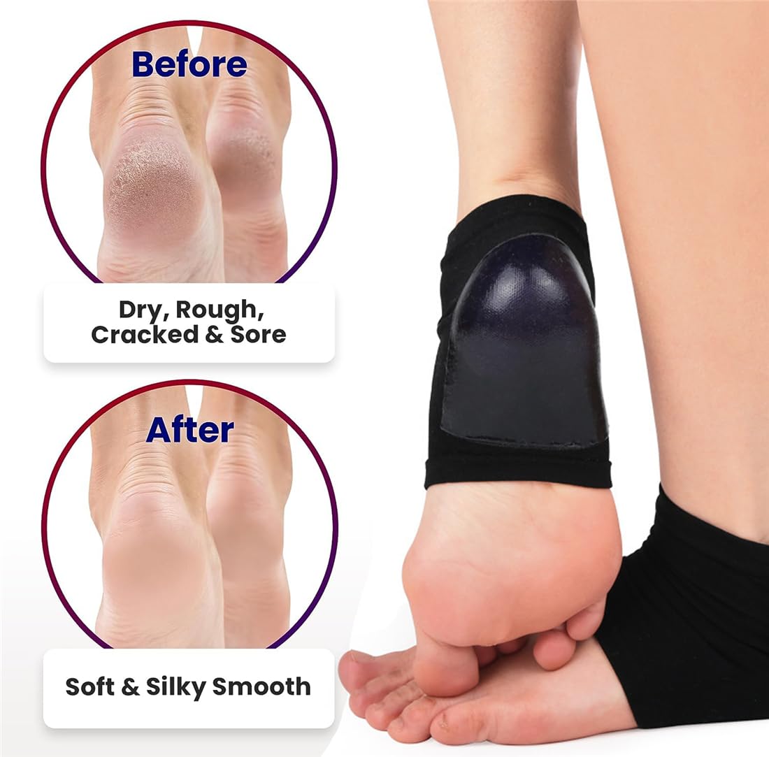 racked Heel Treatment Repair Socks - 2 Pairs Heel Softener Socks for Dry Cracked Feet Heels, Foot Care Toeless Pedicure Moisturizing Socks, Dry Feet Treatment Gel Socks Overnight (Black)