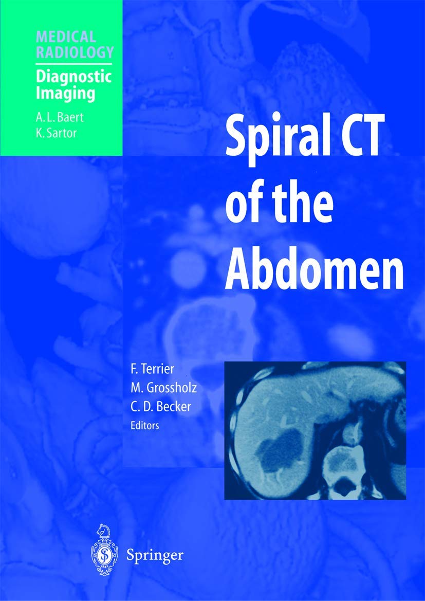Spiral CT of the Abdomen: 9783540422914: Medicine & Health Science ...