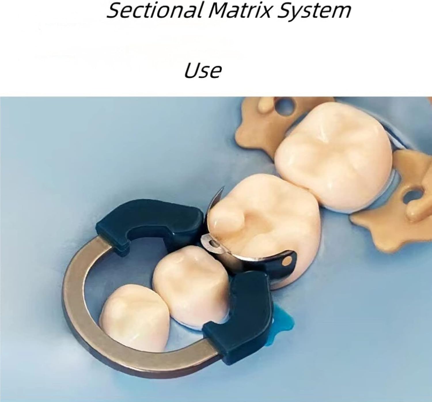 Dental Sectional Matrix System Dental Matrix Ring and Band Set, Dental Sectional Matrix Bands Ring, Dental Clip Clamp Ring, Matrix Bands for Dental Restorations. (R6 Green Ring)