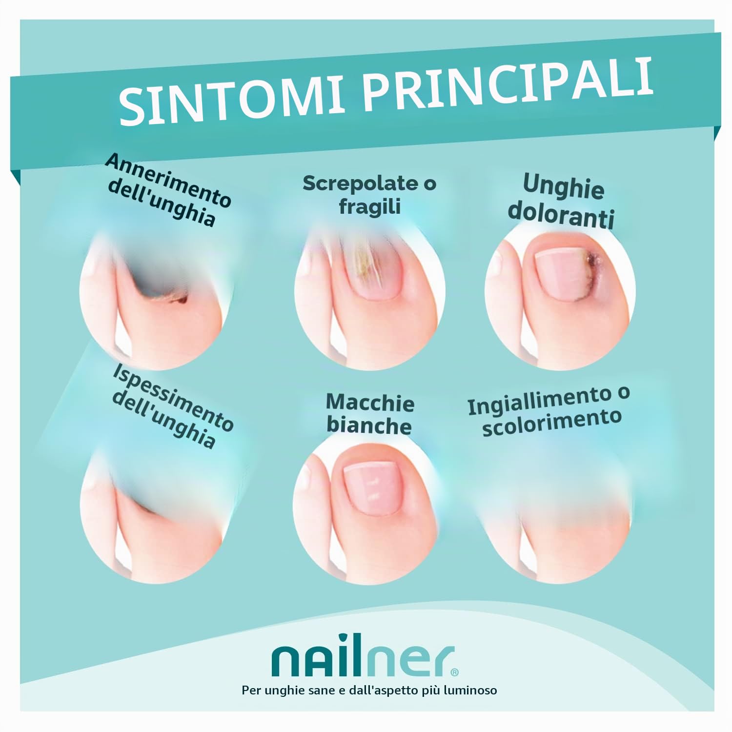 Nailner Trattamento per funghi alle unghie, trattamento e prevenzione delle infezioni fungine delle unghie, smalto naturale con pennello – 5 ml - Nudo