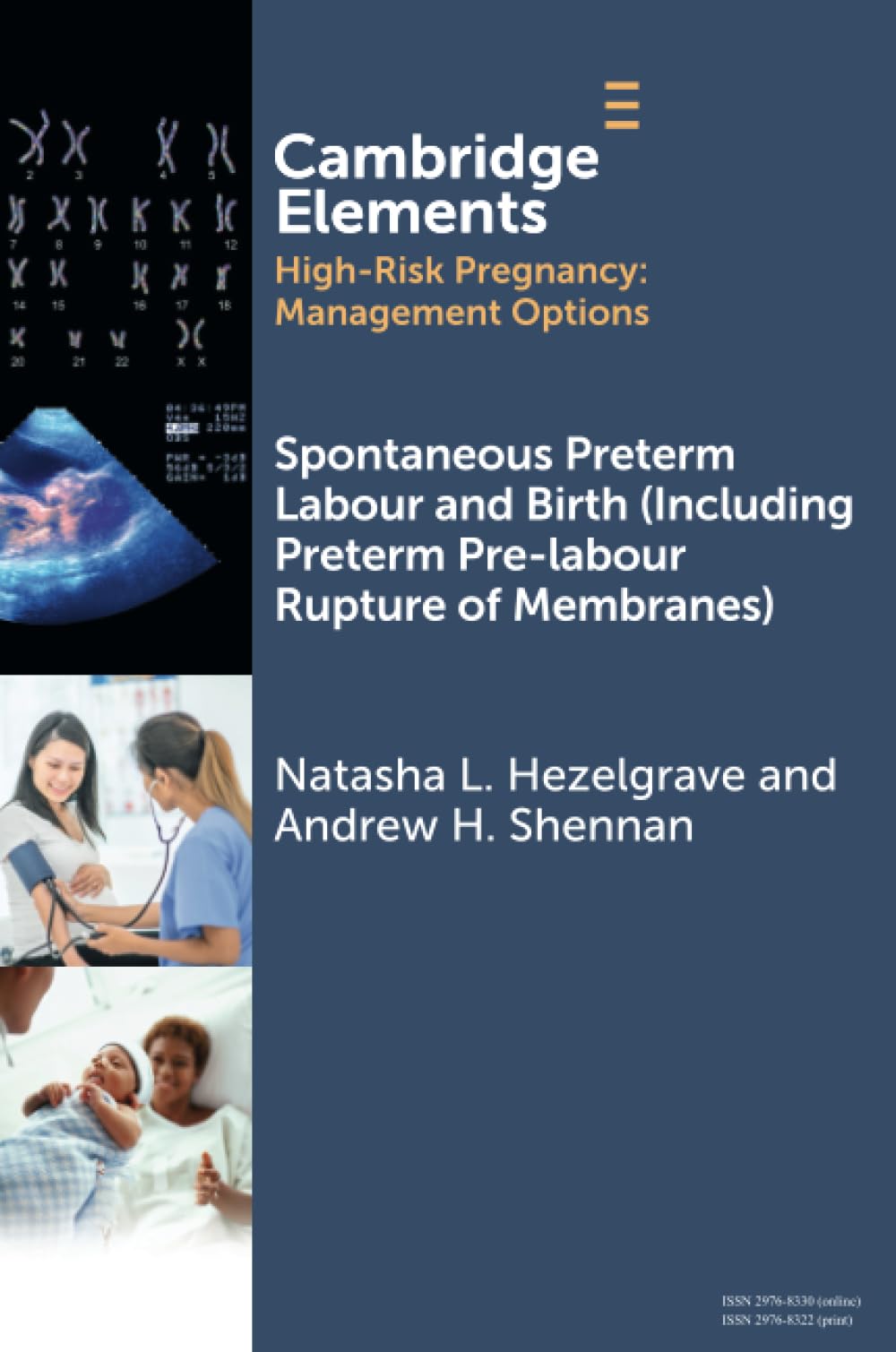 Spontaneous Preterm Labour and Birth (Including Preterm Pre-labour Rupture of Membranes) (Elements in High Risk Pregnancy: Management Options)