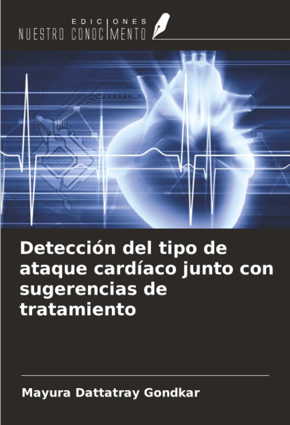 Detección del tipo de ataque cardíaco junto con sugerencias de tratamiento