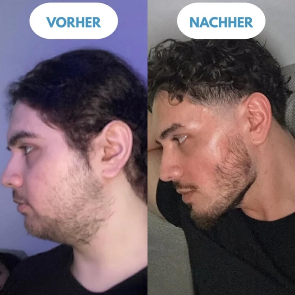 Vespera Clear & Lift Gesichtsmassagegerät - 7 Farben LED,3 Modi, Konstante Erwärmung, V - Shape & Doppelkinn Entfernung, für Damen & Herren