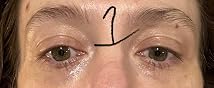 Customer review image for Allergies Injections Extreme Weight Loss
