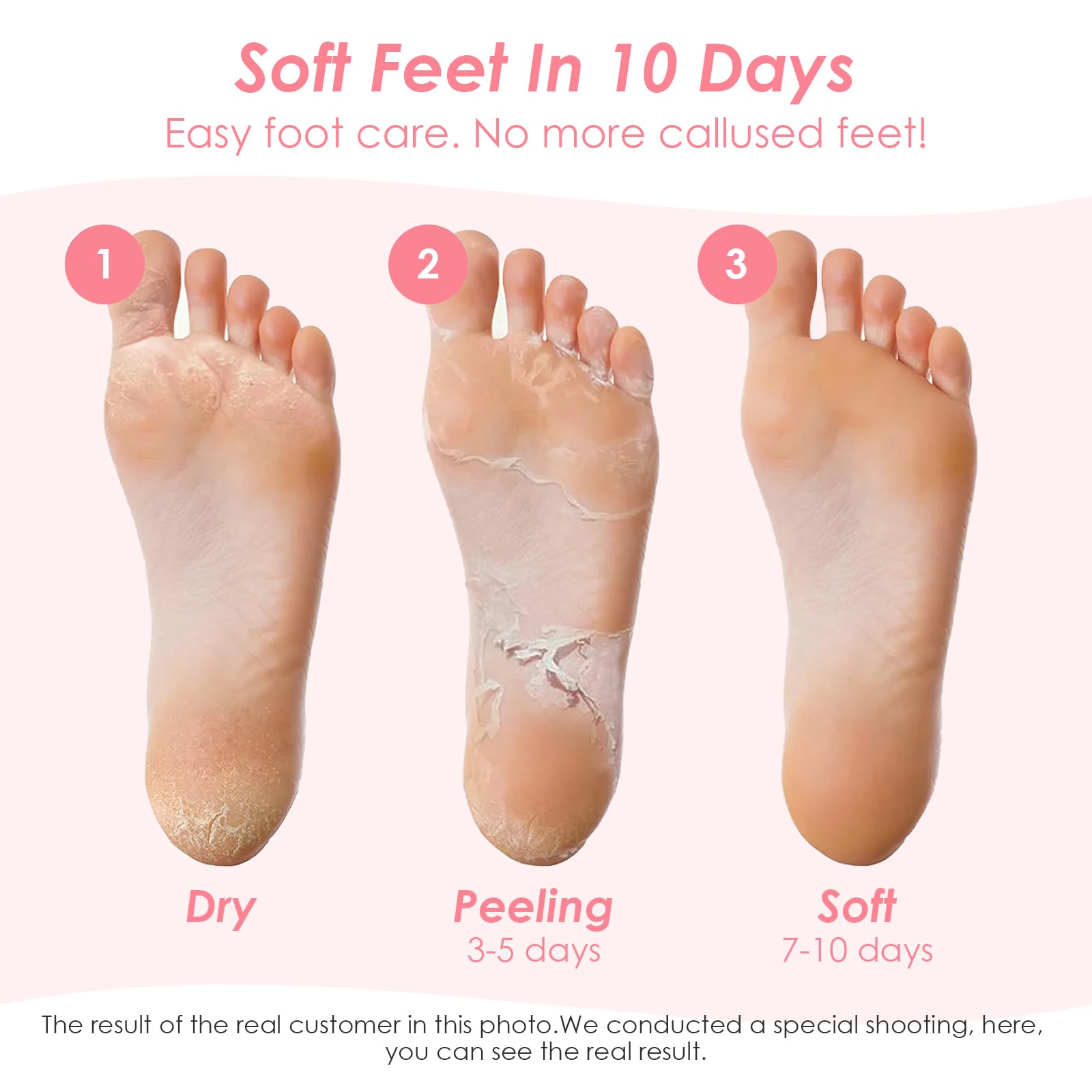2 Paia Maschera Piedi Esfoliante,Maschera per Piedi Efficace Cura dei Piedi i Scrub Piedi,Maschera Esfoliante Piedi per Donne e Uomini,Rimuove Pelle Morta e Secca（ Fragola Pesca）