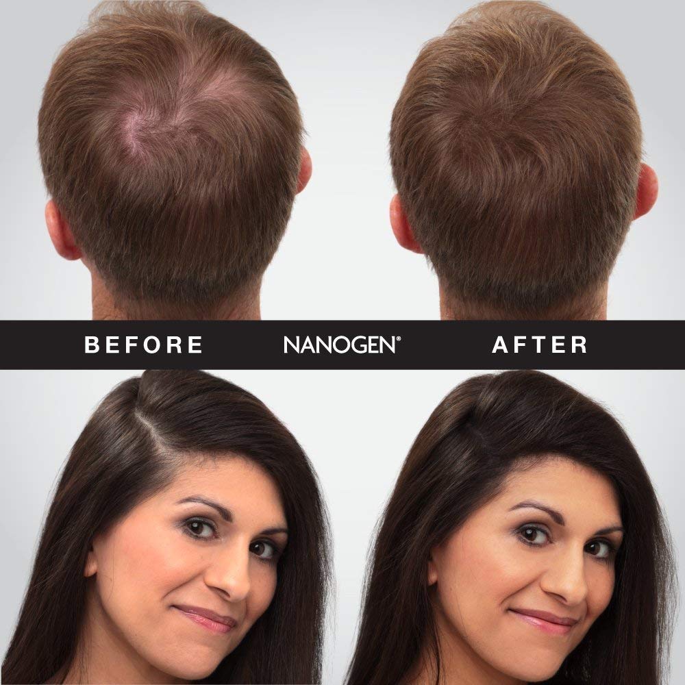 Nanogen Thickening Hair Fibres Hair Touch Up, 30g - Dark Brown 2
