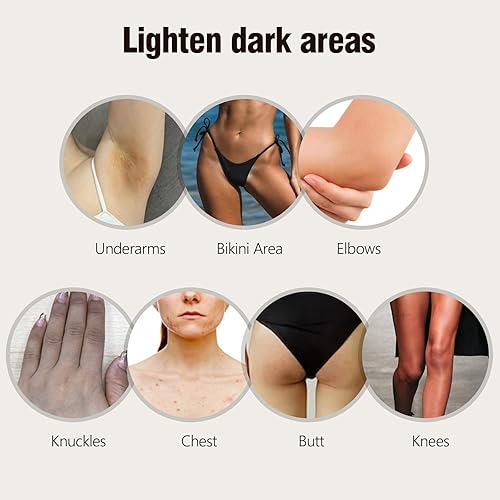 Miniatura 3 de Jabón de ácido kójico para manchas oscuras de hiperpigmentación, barra de jabón de cúrcuma para iluminar la piel con aceite de árbol de té, manteca