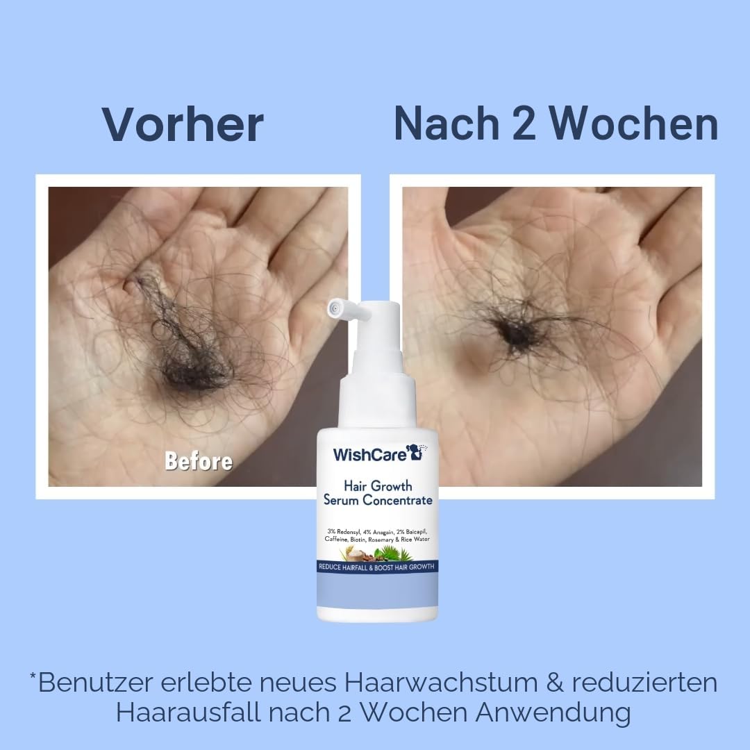 WishCare Haarwachstumsserum mit Rosmarin, Redensyl, Anagain, Baicapil, Koffein, Biotin