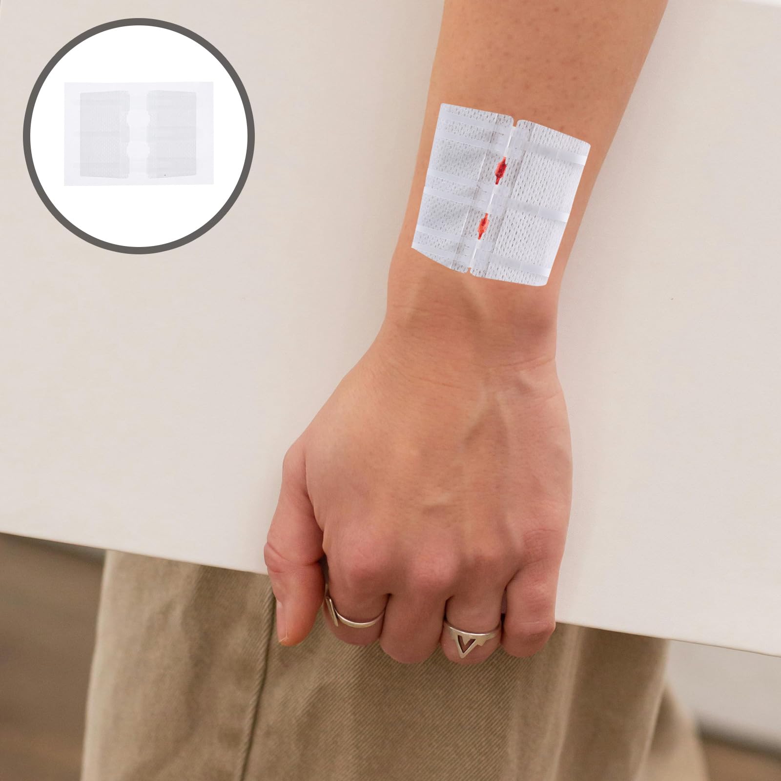 Dispositivo di chiusura della ferita 1 - Longmed Medical