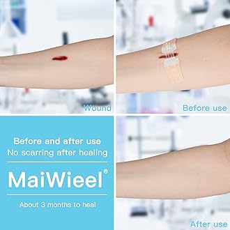 Zip Stitch Laceration Repair Without Stitches Butterfly Bandaids Quick Clot - Emergency Wound Closures Device 2 Pieces (Non-Woven Fabric)