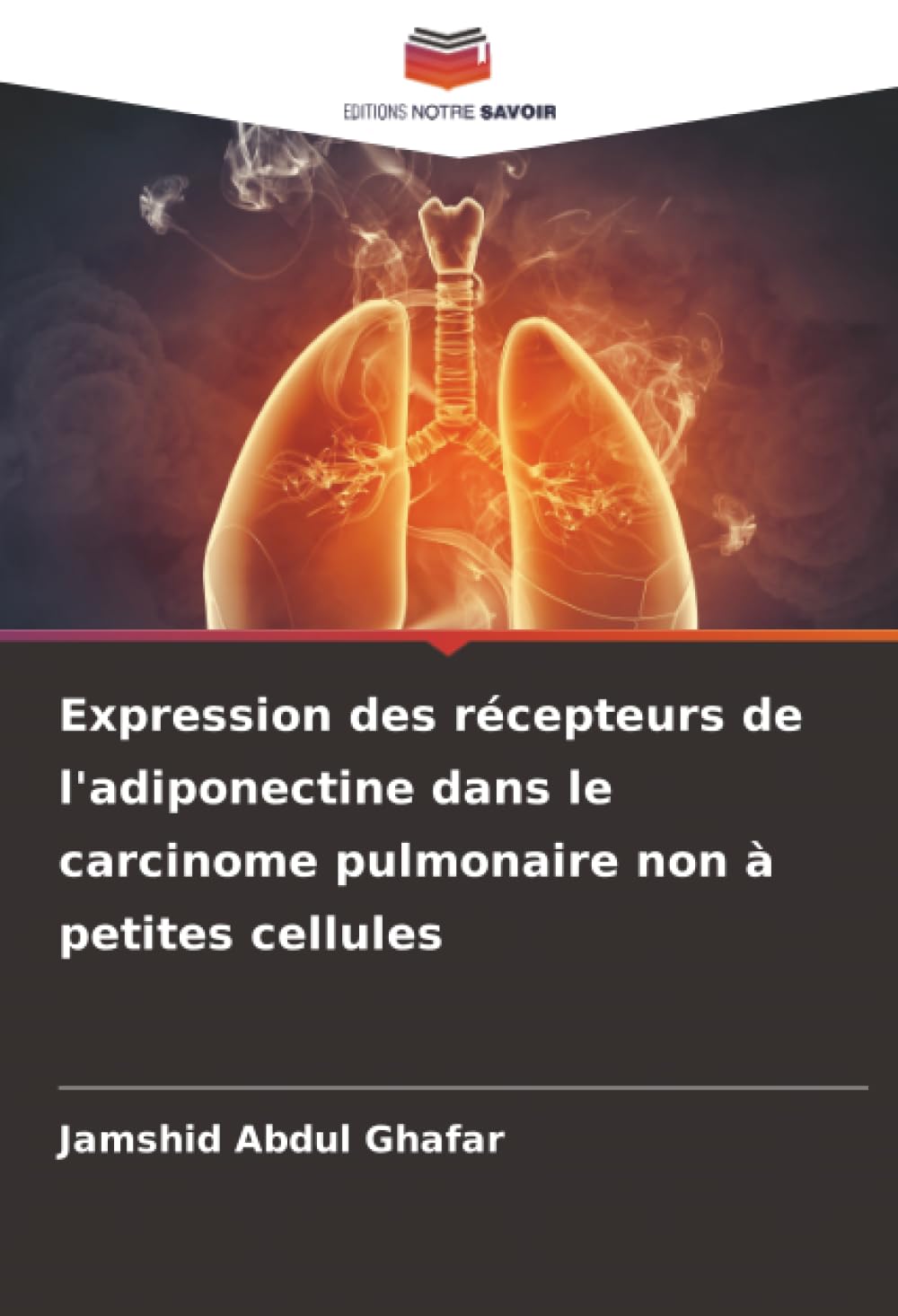 Expression des récepteurs de l'adiponectine dans le carcinome pulmonaire non à petites cellules