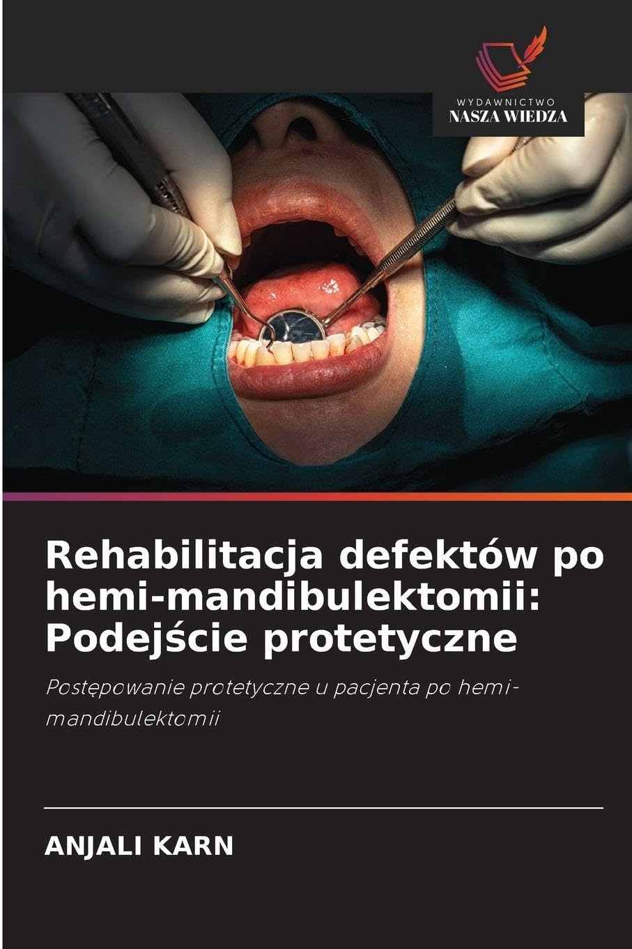 Rehabilitacja defektów po hemi-mandibulektomii: Podej¿cie protetyczne: Post¿powanie protetyczne u pacjenta po hemi-mandibulektomii