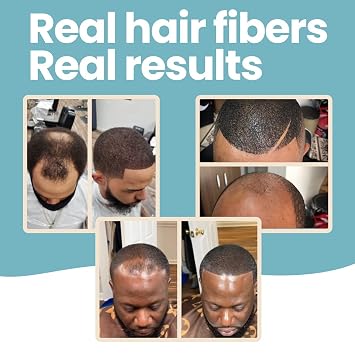 Hair Illusion Black Real Hair Fibers for Thinning Hair - 100% Natural Texture, Non Synthetic Hair Fibers - Bald Spot Cover Up for Women & Men - 38 Gram - Pack of 2