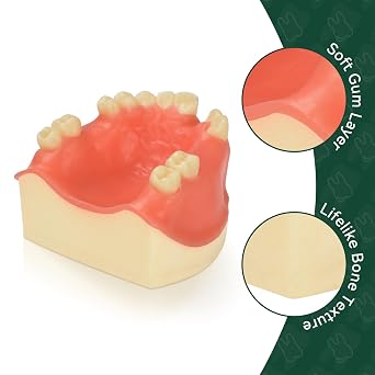Ultrassist Human Maxillary Teeth Model with Missing Partial Teeth