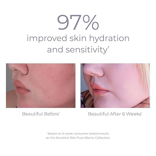 Miniatura 5 de DERMA-E Crema equilibrante Pure Biome, 2 OZ