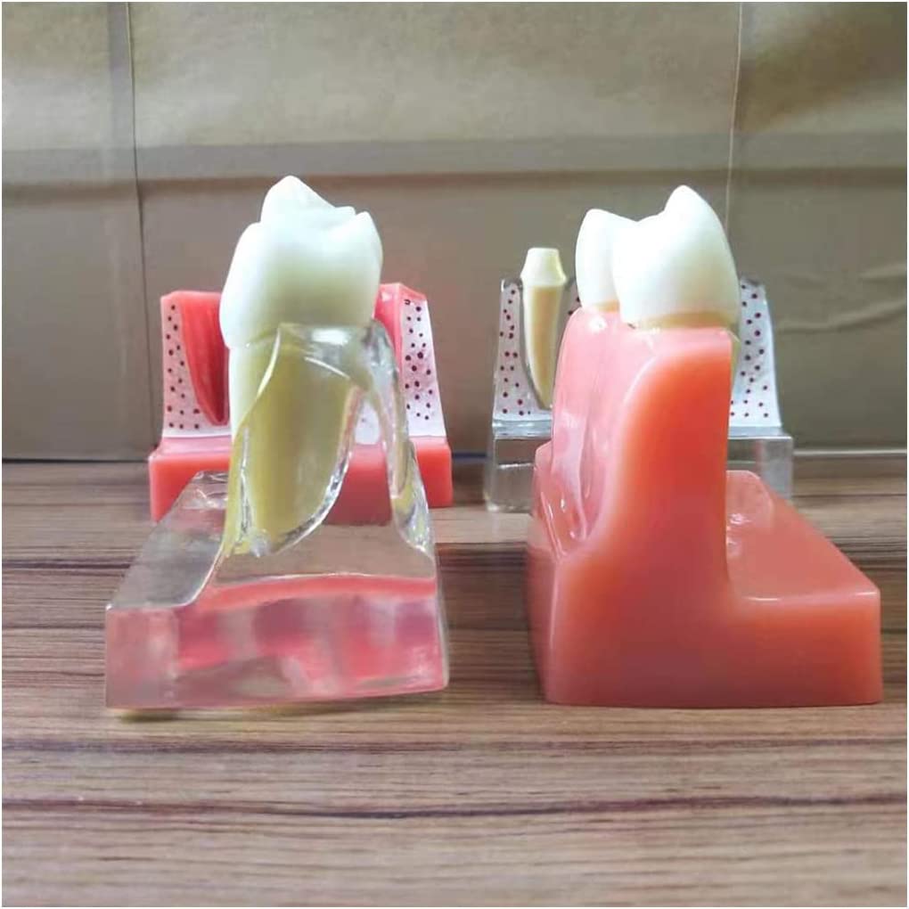 Modèle D'implant Dentaire Modèle D'éducation Dentaire Modèle D'implant Dentaire Degrete Modèle Dentaire sans Dents Modèle D'implant Dentaire Pratique Dental Workforce