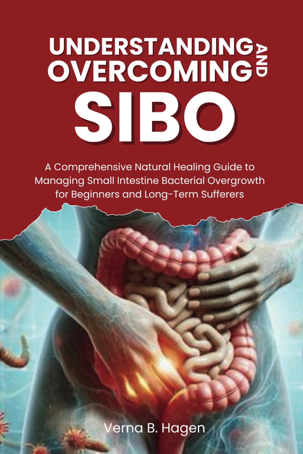 Understanding and Overcoming SIBO: A Comprehensive Natural Healing Guide to Managing Small Intestine Bacterial Overgrowth for Beginners and Long-Term ... Cause Revolution: Your Path to True Health)
