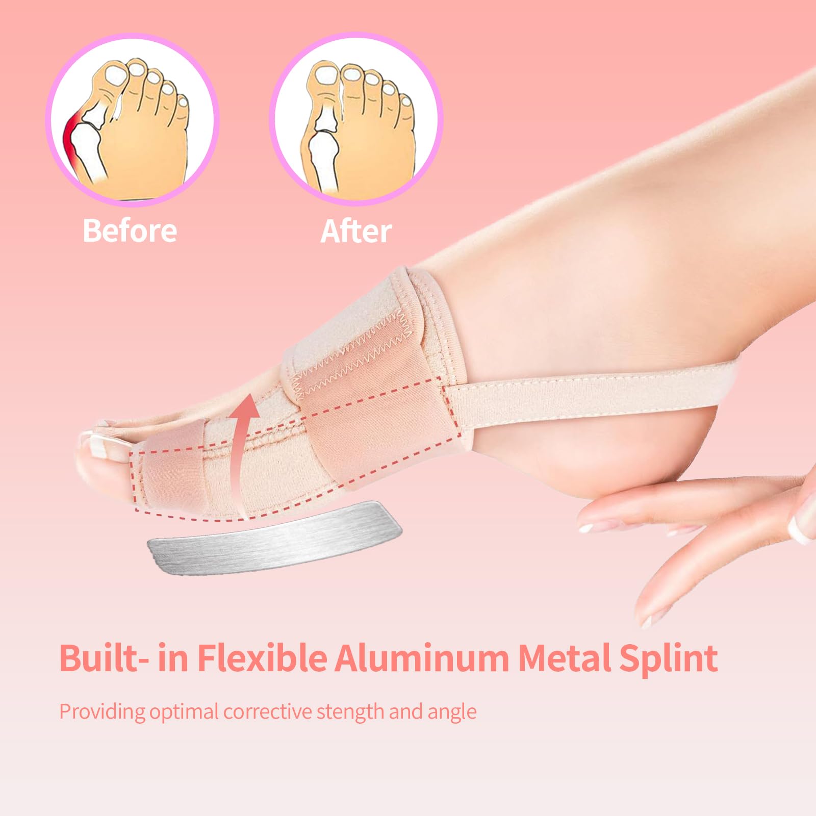 XREKNOi Bunion Corrector, Orthopedic Bunion Splint, Big Toe Pinky Toe Separator for Pain Relief, Non-Surgical Hallux Valgus Correction, Hammer Toe Straightener Kits Pack