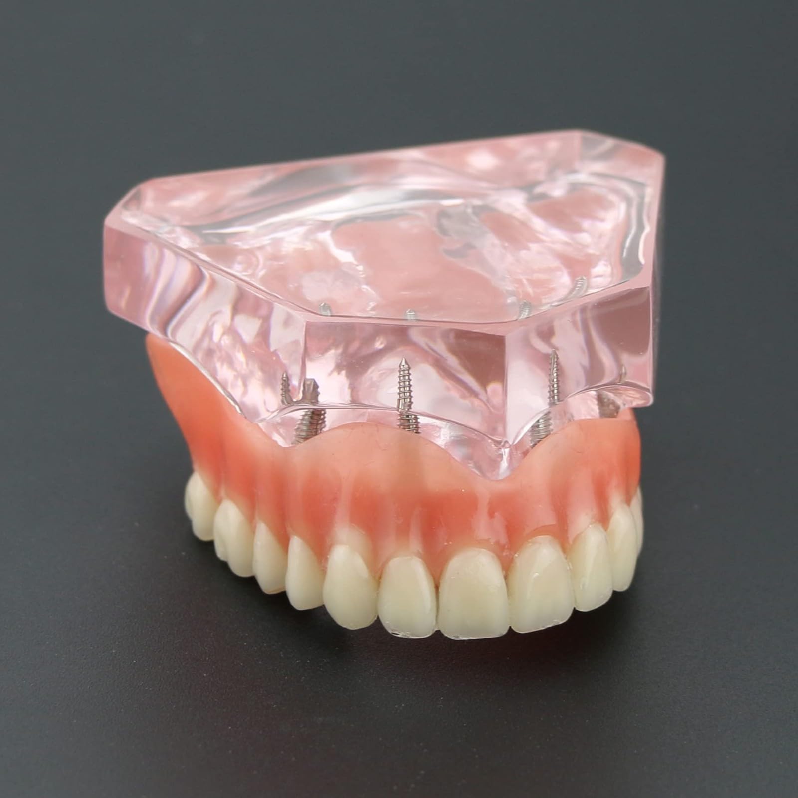 Modelo de dientes para implantes dentales tipodonto, rosa transparente, restauración de implantes dentales tipodonto, sobredentadura, 4 implantes, superior, demostración para estudio y enseñanza.