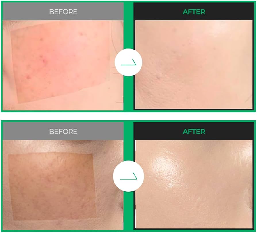 ファンデーション yo--ko3020s ファンデーション yo--ko3020s ファンデーション yo--ko3020s ファンデーション yo--ko3020s