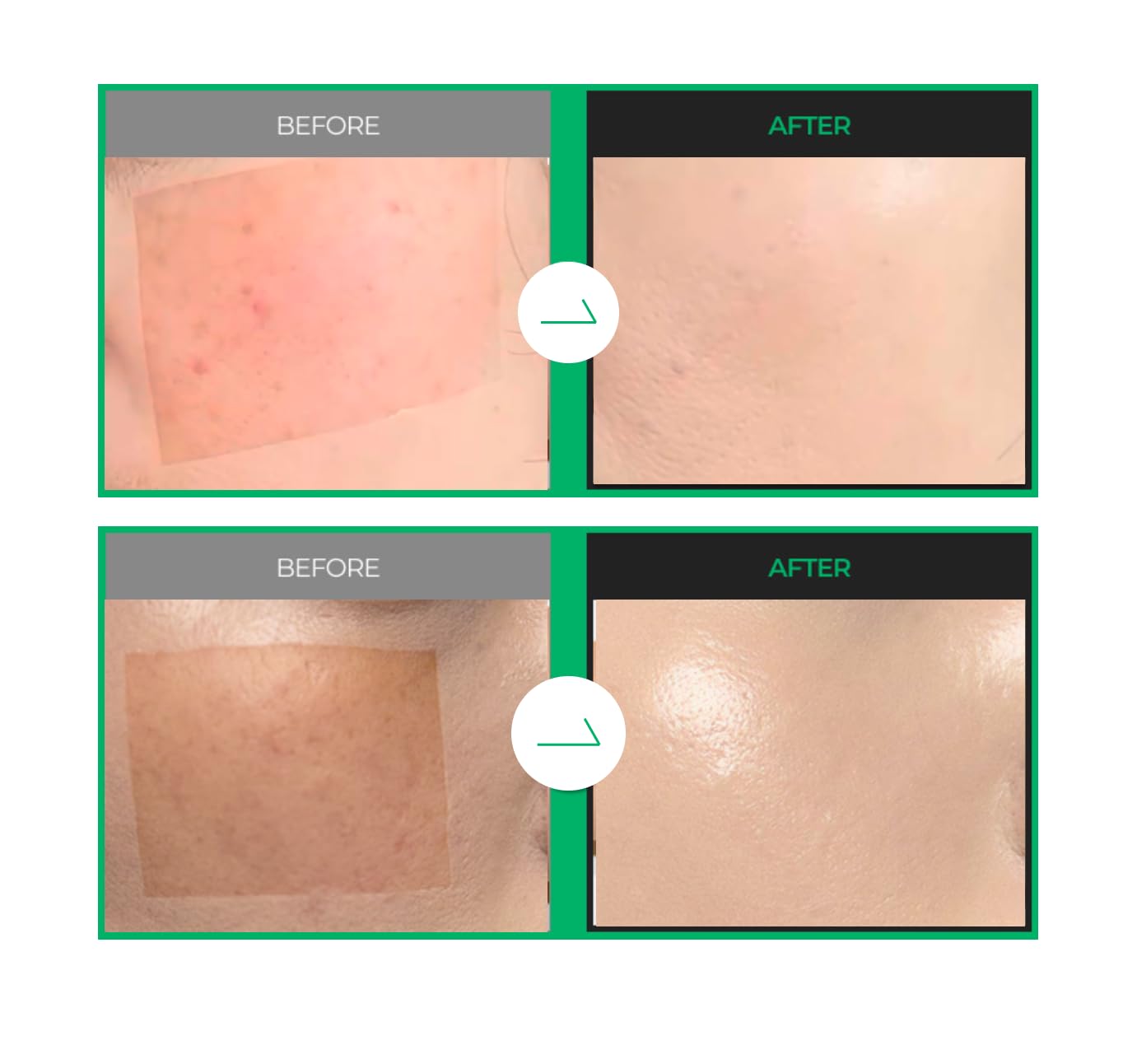 Amazon | 【公式】EGF シミクッション 13g (クッションファンデ/崩れ